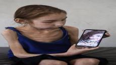 غزة: كارثة إنسانية بين المجاعة والإبادة
